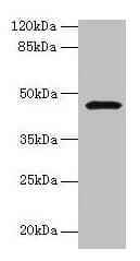 GIF / Intrinsic Factor Antibody (aa19-417)