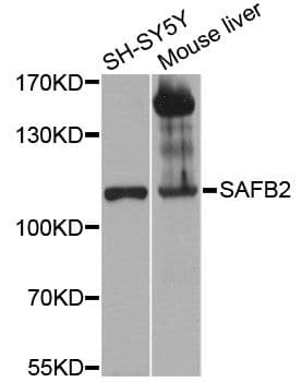 SAFB2 Antibody
