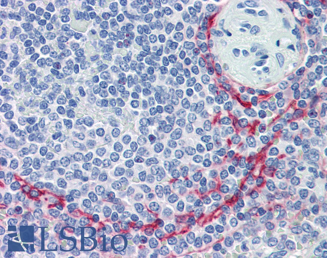 IHC-plus™ Monoclonal Mouse anti-Human MAdCAM-1 Antibody (clone 314G8, Low Endotoxin, IHC)