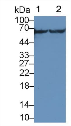 CAMK2G / CaMK II Gamma Antibody (aa14-301, Biotin)