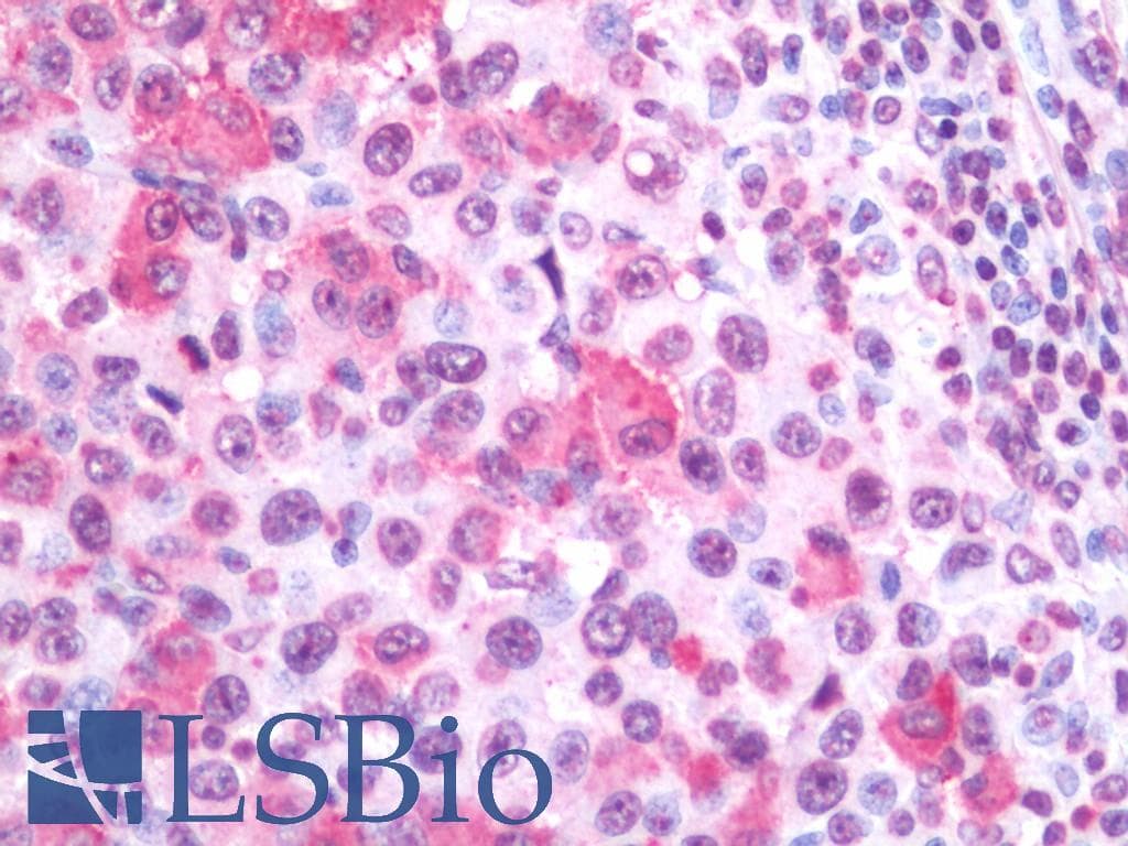 IHC-plus™ WNT10A Antibody (Internal)