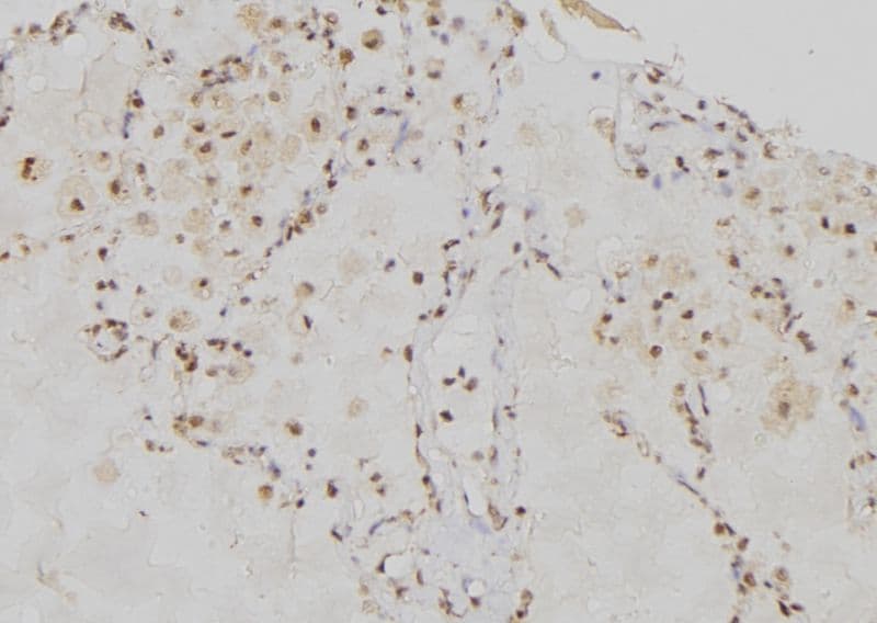 R1 / RRM1 Antibody