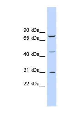 Polyclonal Rabbit anti-Human EGR3 Antibody (C-Terminus, IHC, WB)