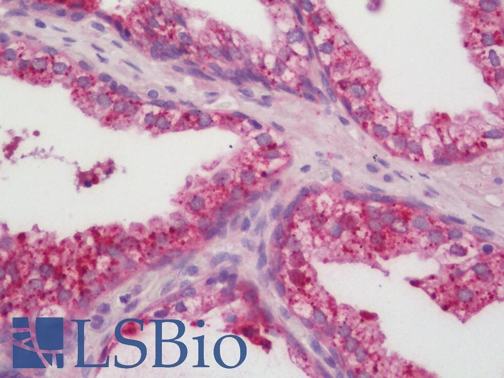 IHC-plus™ Polyclonal Rabbit anti-Human CYP24 / CYP24A1 Antibody (aa400-450, IHC, WB)