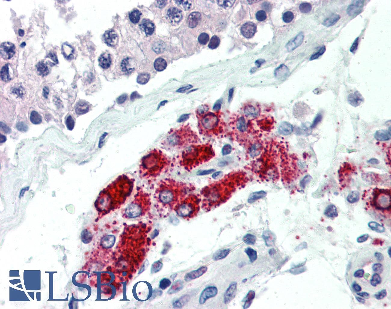 IHC-plus™ Monoclonal Mouse anti-Human NKX3-1 Antibody (clone 3-9, N-Terminus, IHC, WB)