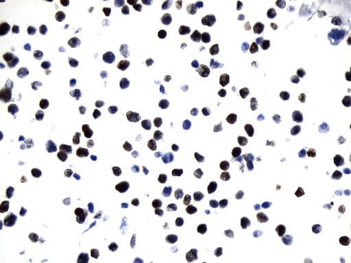 UCHL1 / PGP9.5 Antibody (clone UMAB244)