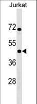 IKBIP Antibody (aa319-345)