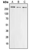 IHC-plus™ Polyclonal Rabbit anti-Human CACNA1E / Cav2.3 Antibody (Internal, IHC, WB)