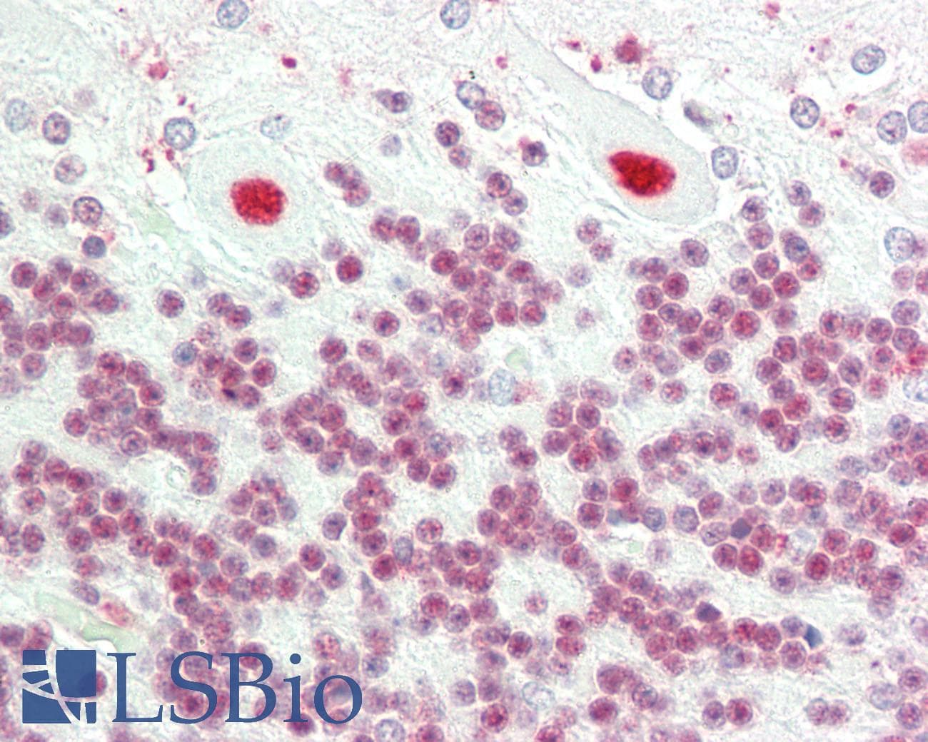 IHC-plus™ NCL / Nucleolin Antibody (clone 4E2)