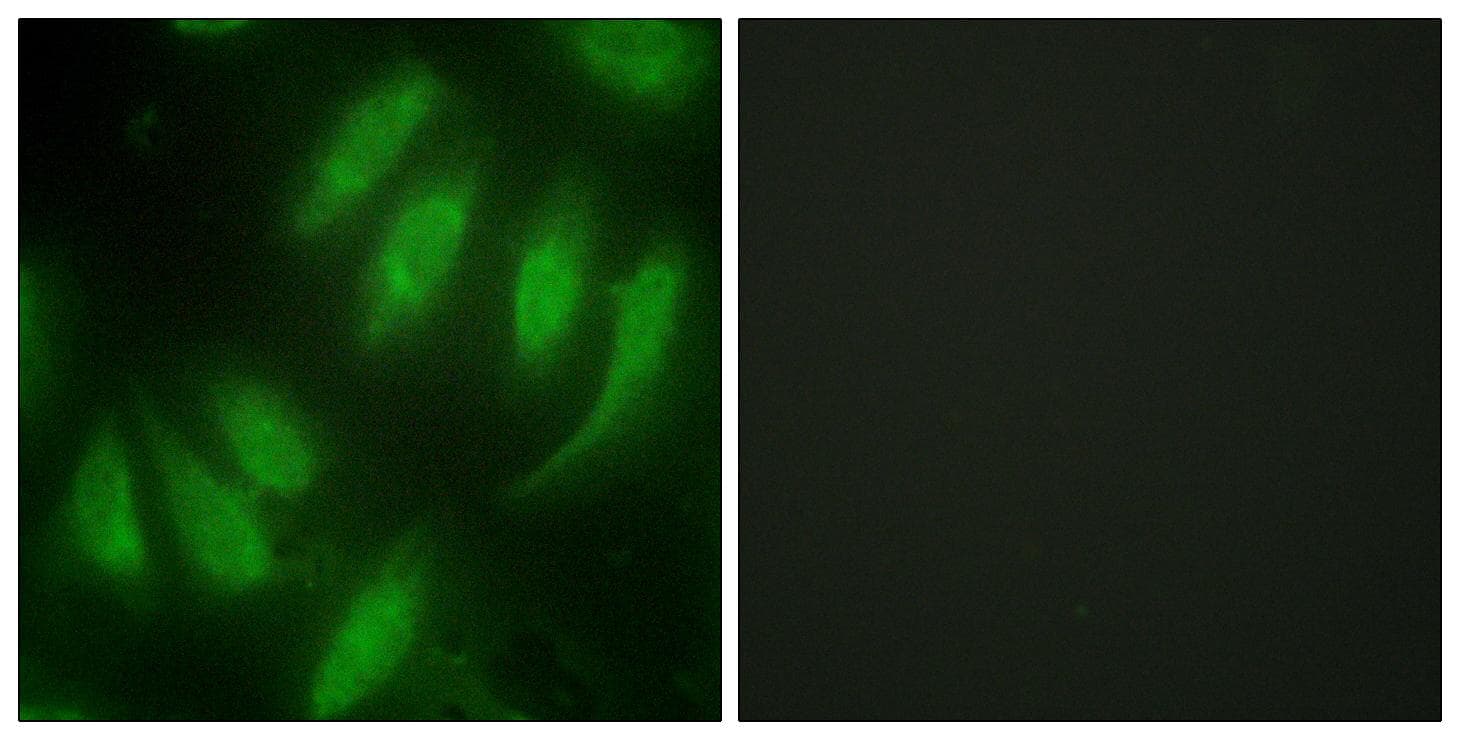 Polyclonal Rabbit anti-Human HEXIM1 Antibody (IF, WB)