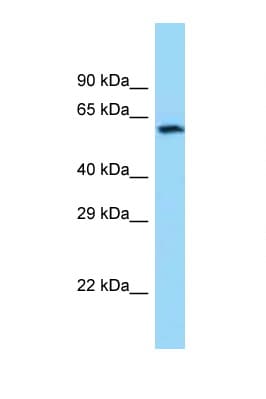 CHAT Antibody (C-Terminus)