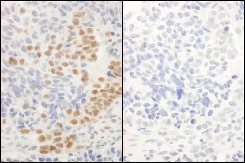 RELA / NFKB p65 Antibody (phospho-Ser536)