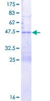 Human TTDN1 Protein (Recombinant GST)