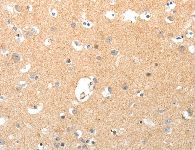 TNXB / Tenascin XB Antibody