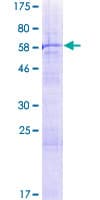 Human PARP11 Protein (Recombinant GST)