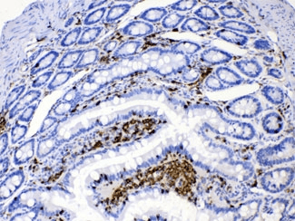DHODH Antibody