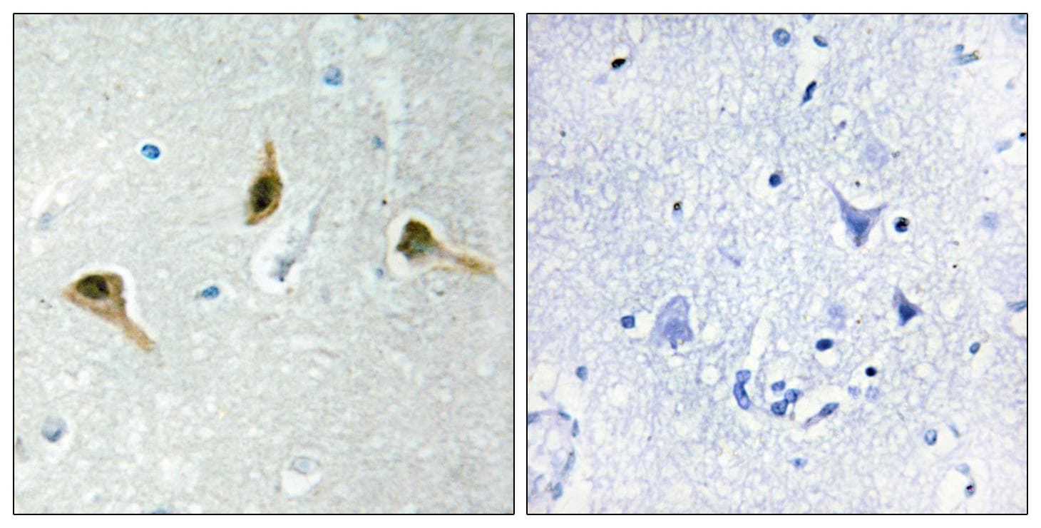 MSH2 Antibody