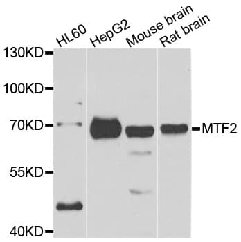 Polyclonal Rabbit anti-Human MTF2 / PCL2 Antibody (IHC, IF, WB)