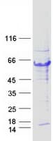 Human TRIM44 Protein (Recombinant Myc-DDK (Flag))