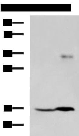 Polyclonal Rabbit anti-Human TMEM42 Antibody (WB)