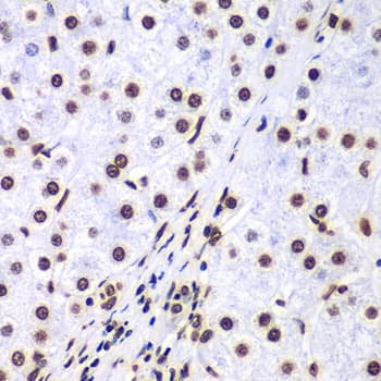 Polyclonal Rabbit anti-Human Histone H3 Antibody (IHC, IF, WB)