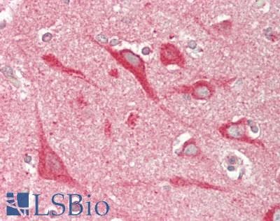 IHC-plus™ SLC9A6 Antibody (aa600-650)