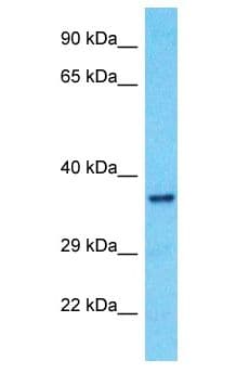 Polyclonal Rabbit anti-Human OR10A7 Antibody (aa265-314, WB)