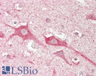 IHC-plus™ Polyclonal Rabbit anti-Human DCLK / DCLK1 Antibody (aa690-740, IHC, WB)