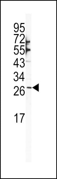 SNAI1 / SNAIL-1 Antibody (aa1-30)