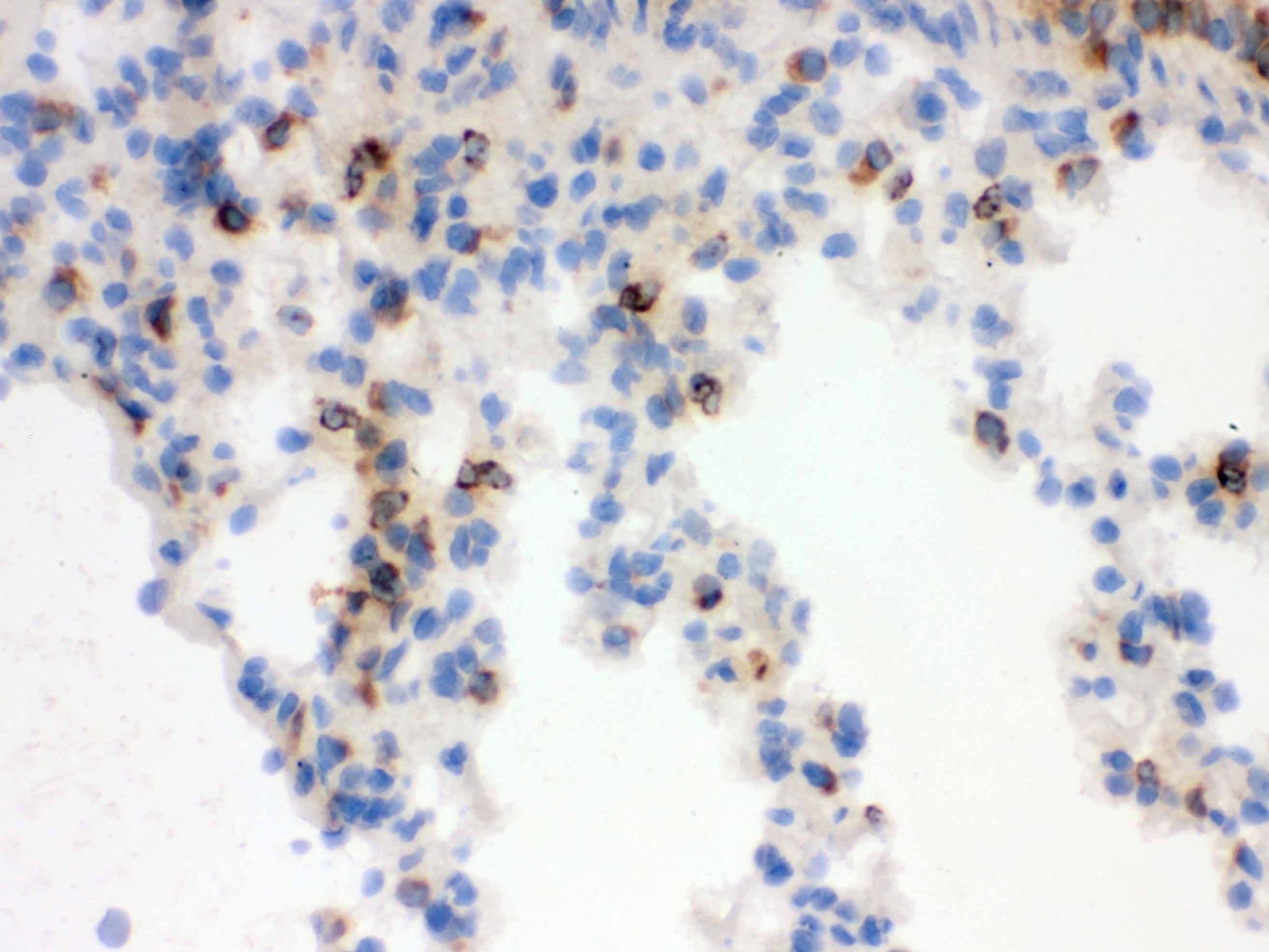 LCN2 / Lipocalin 2 / NGAL Antibody (aa21-200)