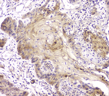 RAB11B Antibody