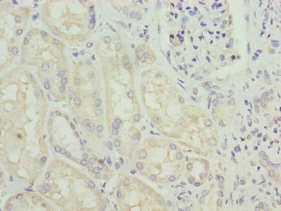 GLS / Glutaminase Antibody