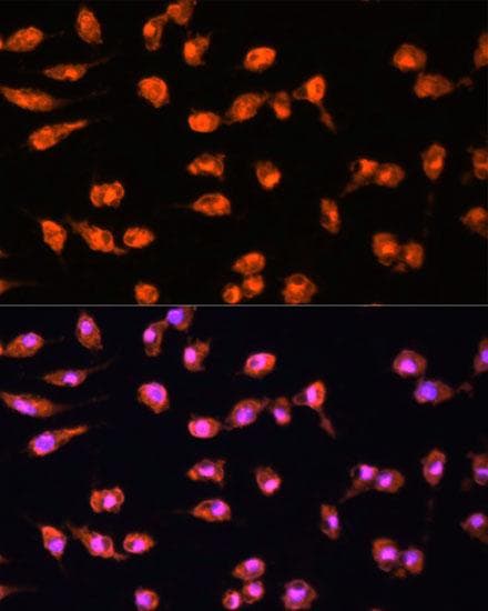 PRKCB / PKC-Beta Antibody
