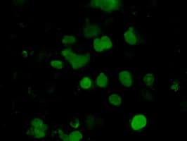 EMG1 / NEP1 Antibody (clone OTI1B8)