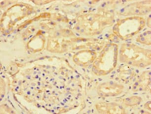 SART2 / DSE Antibody