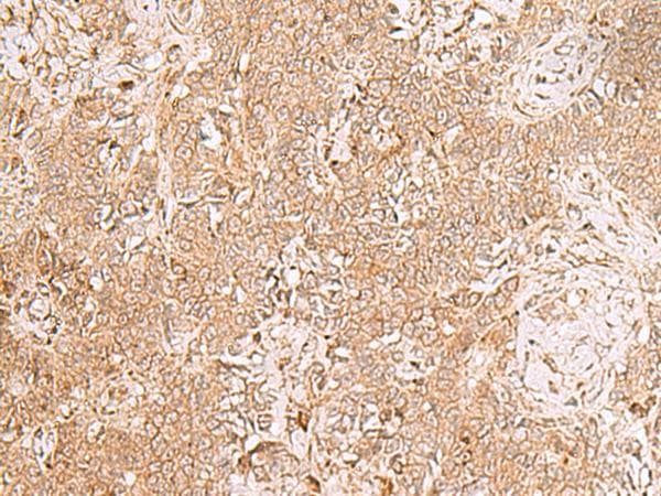 GMPPB Antibody