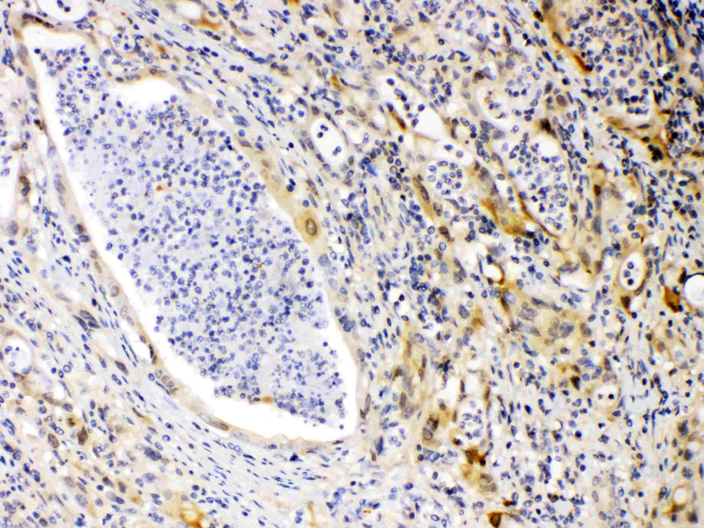 PRKAR1A Antibody