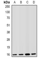 Polyclonal Rabbit anti-Human FIS1 Antibody (IF, WB)
