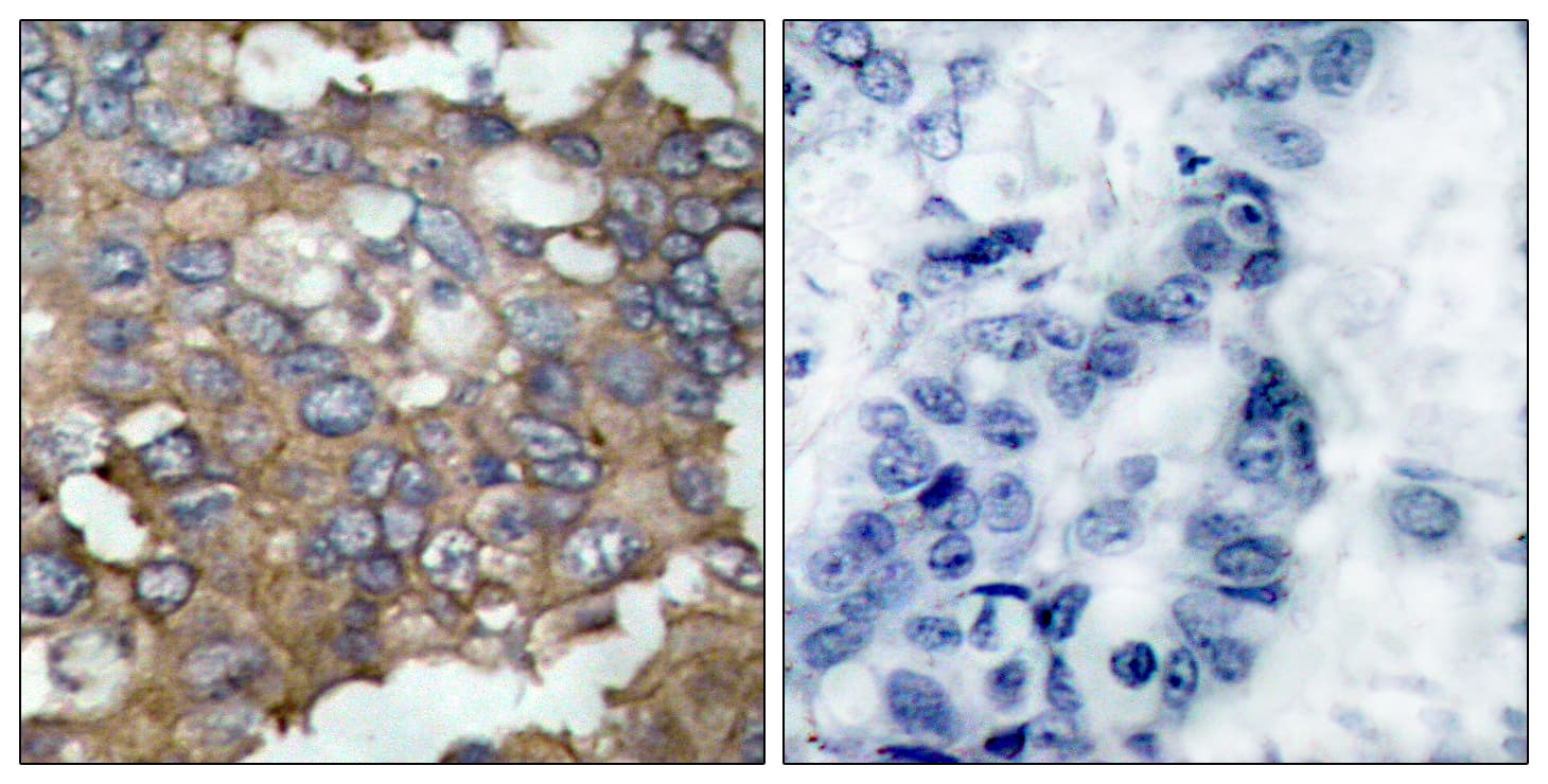 Polyclonal Rabbit anti-Human SRC Antibody (aa487-536, IHC, WB)