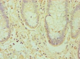 Polyclonal Rabbit anti-Human EFNA1 / Ephrin A1 Antibody (aa19-182, IHC)