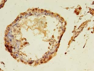 TMCO5A Antibody (Coiled-coil domain)