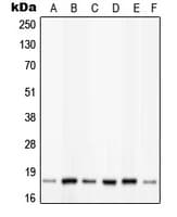 Polyclonal Rabbit anti-Human PIN1 Antibody (phospho-Ser16, WB)