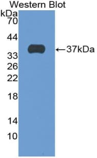 SFTPD / Surfactant Protein D Antibody (aa21-375, Biotin)