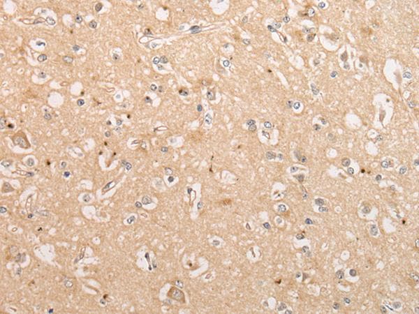 C15orf40 Antibody