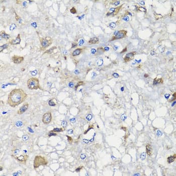 BCS1L Antibody