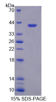 Mouse MYBPC1 Protein (Recombinant His-T7)