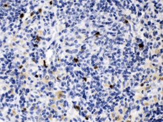 MMP9 / Gelatinase B Antibody