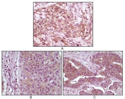 EIF4EBP1 / 4EBP1 Antibody (clone 11G12C11)
