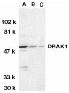 Polyclonal Rabbit anti-Human DRAK1 / STK17A Antibody (IF, WB)