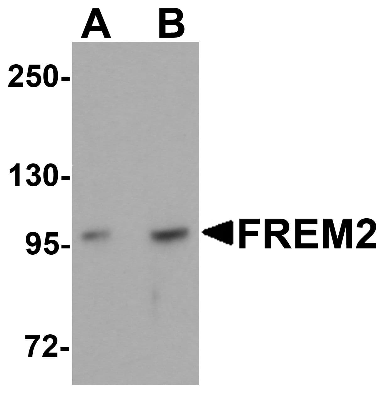 IHC-plus™ FREM2 Antibody